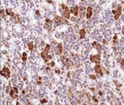 Immunohistochemistry-Paraffin: ACTH Antibody (AH26) - Azide and BSA Free [NBP2-33072] - Formalin-paraffin human Pituitary Gland stained with ACTH ab (AH26).