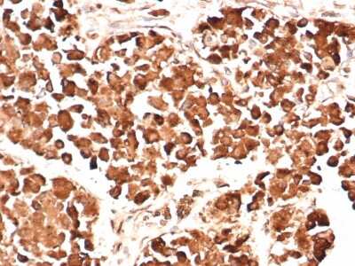 Immunohistochemistry-Paraffin: ACTH Antibody (AH26) - Azide and BSA Free [NBP2-33072] - Formalin-fixed, paraffin-embedded human pituitary gland stained with ACTH Antibody (AH26).