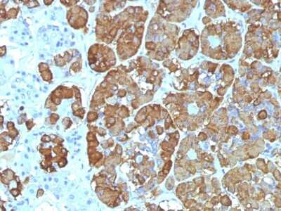 Immunohistochemistry-Paraffin: ACTH Antibody (CLIP/1449) [NBP2-54324] - Formalin-fixed, paraffin-embedded Human Pituitary stained with ACTH Monoclonal Antibody (CLIP/1449).