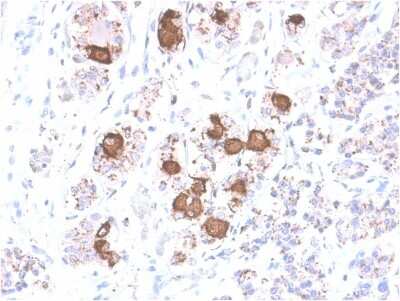 Immunohistochemistry-Paraffin: ACTH Antibody (CLIP/2040R) [NBP3-07627] - Formalin-fixed, paraffin-embedded human Pituitary stained with ACTH Rabbit Recombinant Monoclonal Antibody (CLIP/2040R).