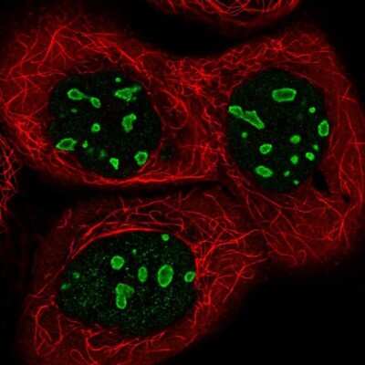 Immunocytochemistry/Immunofluorescence: ACTL6B Antibody [NBP1-91648] - Staining of human cell line A-431 shows localization to nucleoli. Antibody staining is shown in green.