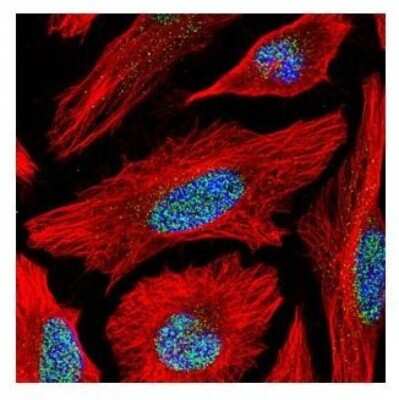 Immunocytochemistry/Immunofluorescence: ACTL6B Antibody [NBP2-15269] - Paraformaldehyde-fixed HeLa, using Actin like 6B antibody (Green) at 1:500 dilution. Alpha-tubulin filaments were labeled with an alpha Tubulin antibody (Red) at 1:2000.