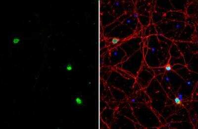 Immunocytochemistry/Immunofluorescence: ACTL6B Antibody [NBP2-15269] - ACTL6B antibody detects ACTL6B protein by immunofluorescent analysis. Sample: DIV9 rat E18 primary cortical neuron cells were fixed in 4% paraformaldehyde at RT for 15 min.