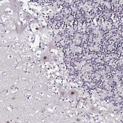 Immunohistochemistry-Paraffin: ACTL6B Antibody [NBP1-91648] - Staining of human cerebellum shows moderate nuclear positivity in Purkinje cells.