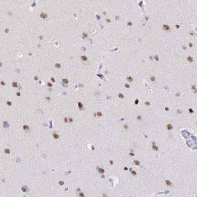 Immunohistochemistry-Paraffin: ACTL6B Antibody [NBP1-91648] - Staining of human cerebral cortex shows moderate nuclear positivity in neurons.