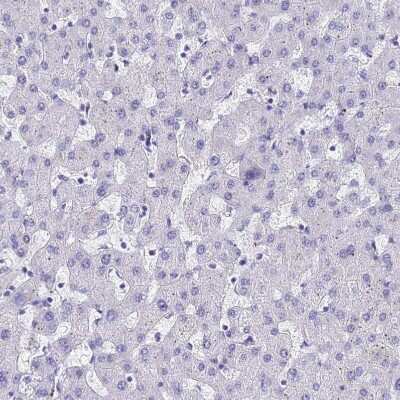 Immunohistochemistry-Paraffin: ACTL6B Antibody [NBP1-91648] - Staining of human liver shows no positivity in hepatocytes as expected.