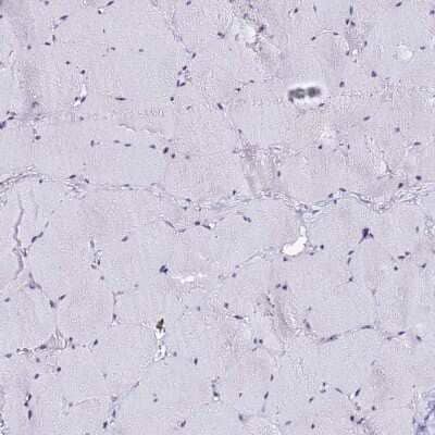 Immunohistochemistry-Paraffin: ACTL6B Antibody [NBP1-91648] - Staining of human skeletal muscle shows no positivity in myocytes as expected.