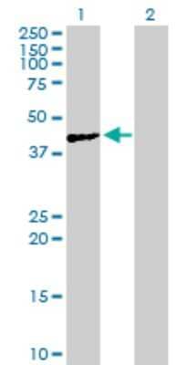 Western Blot: ACTL7A Antibody [H00010881-B01P] - Analysis of ACTL7A expression in transfected 293T cell line by ACTL7A polyclonal antibody.  Lane 1: ACTL7A transfected lysate(47.85 KDa). Lane 2: Non-transfected lysate.