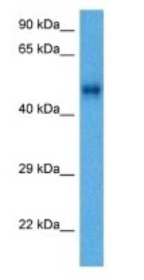 Western Blot: ACTL7A Antibody [NBP3-10804] - Western blot analysis of ACTL7A in Human Mesenchymoma Tumor lysates. Antibody dilution at 1ug/ml