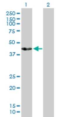 Western Blot: ACTL7B Antibody [H00010880-D01P] - Analysis of ACTL7B expression in transfected 293T cell line by ACTL7B polyclonal antibody.Lane 1: ACTL7B transfected lysate(45.20 KDa).Lane 2: Non-transfected lysate.