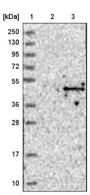 Western Blot ACTL8 Antibody - BSA Free