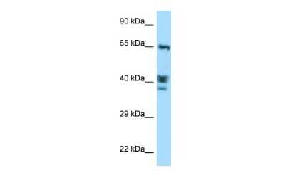 Western Blot: ACTL8 Antibody [NBP2-86952] - WB Suggested Anti-ACTL8 Antibody. Titration: 1.0 ug/ml. Positive Control: MCF7 Whole Cell