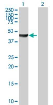 Western Blot: ACTR10 Antibody [H00055860-B01P] - Analysis of ACTR10 expression in transfected 293T cell line by ACTR10 polyclonal antibody.  Lane 1: ACTR10 transfected lysate(45.87 KDa). Lane 2: Non-transfected lysate.
