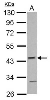 Western Blot: ACTR10 Antibody [NBP2-15273] - Sample (30 ug of whole cell lysate) A: NT2D1 10% SDS PAGE; antibody diluted at 1:1000.