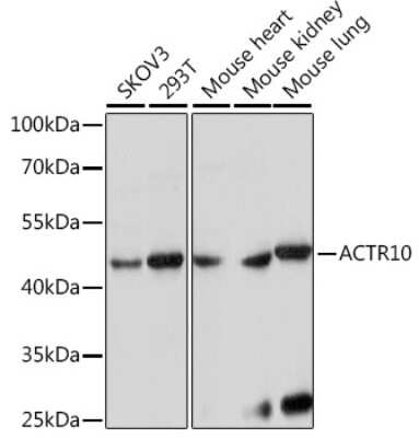 Western Blot: ACTR10 Antibody [NBP2-92268] - Analysis of extracts of various cell lines, using ACTR10 at 1:1000 dilution.Secondary antibody: HRP Goat Anti-Rabbit IgG (H+L) at 1:10000 dilution.Lysates/proteins: 25ug per lane.Blocking buffer: 3% nonfat dry milk in TBST.Detection: ECL Basic Kit .Exposure time: 30s.