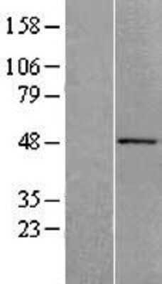 Western Blot: ACTR10 Overexpression Lysate (Adult Normal) [NBL1-07284] Left-Empty vector transfected control cell lysate (HEK293 cell lysate); Right -Over-expression Lysate for ACTR10.