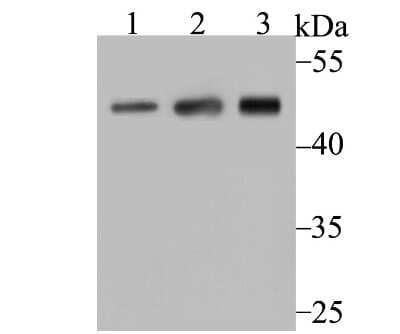Western Blot: ACTR3 Antibody (JB33-44) [NBP2-75395] - Analysis of Arp3 on different lysates using anti-Arp3 antibody at 1/500 dilution.Positive control:Lane 1: A431    Lane 2: Mouse placentaLane 3: Mouse thymus