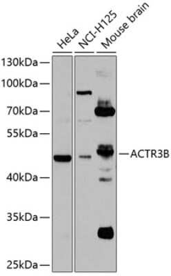 Western Blot ACTR3B Antibody - BSA Free