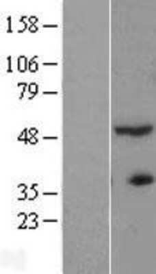 Western Blot ACTR3B Overexpression Lysate