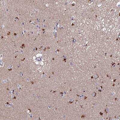 Immunohistochemistry: ACTR5 Antibody [NBP2-14524] - Staining of human lateral ventricle shows strong cytoplasmic positivity in neuronal cells.