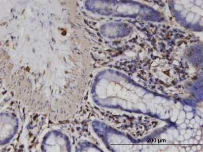 Immunohistochemistry-Paraffin: ACTRT2 Antibody (2E10) [H00140625-M03] - Analysis of monoclonal antibody to ACTRT2 on formalin-fixed paraffin-embedded human colon. Antibody concentration 3 ug/ml