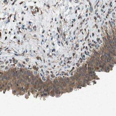 Immunohistochemistry: ACTRT2 Antibody [NBP1-89005] - Staining of human urinary bladder shows moderate cytoplasmic positivity in urothelial cells.