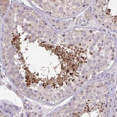 Immunohistochemistry-Paraffin: ACTRT2 Antibody [NBP1-89005] - Staining of human testis shows high expression.