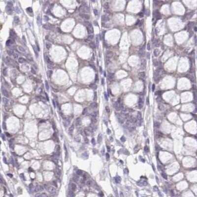 Immunohistochemistry-Paraffin: ACTRT2 Antibody [NBP1-89005] - Staining of human colon.