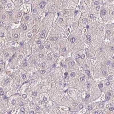 Immunohistochemistry-Paraffin ACTRT2 Antibody - BSA Free