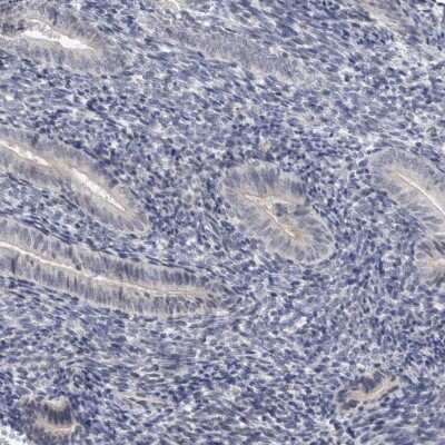 Immunohistochemistry-Paraffin ACTRT2 Antibody - BSA Free