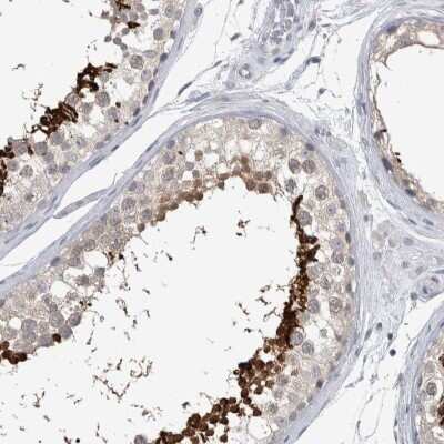 Immunohistochemistry-Paraffin ACTRT2 Antibody - BSA Free