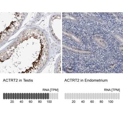 Immunohistochemistry-Paraffin ACTRT2 Antibody - BSA Free