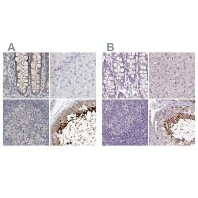 <b>Independent Antibodies Validation and Orthogonal Strategies Validation.</b>Immunohistochemistry-Paraffin: ACTRT2 Antibody [NBP1-89006] - Staining of human colon, liver, lymph node and testis using Anti-ACTRT2 antibody NBP1-89006 (A) shows similar protein distribution across tissues to independent antibody NBP1-89005 (B).