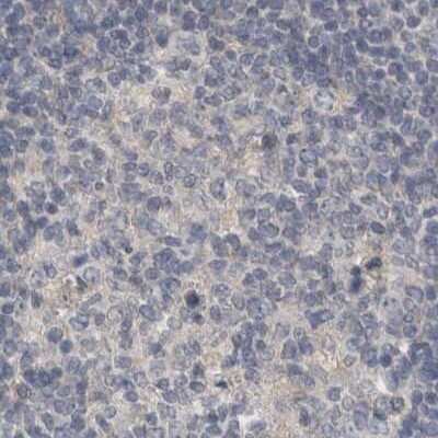 Immunohistochemistry-Paraffin: ACTRT2 Antibody [NBP1-89006] - Staining of human lymph node.