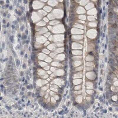 Immunohistochemistry-Paraffin: ACTRT2 Antibody [NBP1-89006] - Staining of human colon.