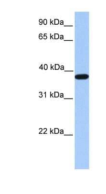 Western Blot: ACTRT2 Antibody [NBP1-54626] - Human Muscle lysate, concentration 0.2-1 ug/ml.