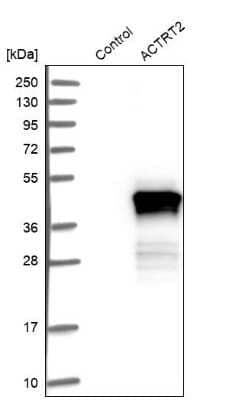 Western Blot: ACTRT2 Antibody [NBP1-89006] - Analysis in control (vector only transfected HEK293T lysate) and ACTRT2 over-expression lysate (Co-expressed with a C-terminal myc-DDK tag (3.1 kDa) in mammalian HEK293T cells).