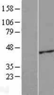 Western Blot ACTRT2 Overexpression Lysate