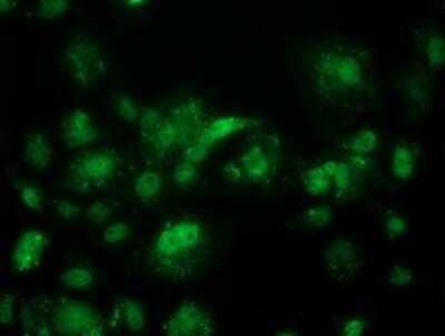 Immunocytochemistry/Immunofluorescence: ACY3 Antibody (2D5) [NBP2-03512] - Staining of COS7 cells transiently transfected by pCMV6-ENTRY ACY3.