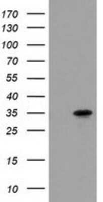 Western Blot: ACY3 Antibody (2D5) [NBP2-03512] - HEK293T cells were transfected with the pCMV6-ENTRY control (Left lane) or pCMV6-ENTRY ACY3 (Right lane) cDNA for 48 hrs and lysed. Equivalent amounts of cell lysates (5 ug per lane) were separated by SDS-PAGE and immunoblotted with anti-ACY3.