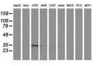 Western Blot ACY3 Antibody (OTI2D5)