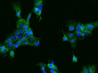 Immunocytochemistry/Immunofluorescence: ACY3 Antibody [NBP2-99167] - Immunofluorescence staining of ACY3 in A431 cells. Cells were fixed with 4% PFA, permeabilzed with 0.1% Triton X-100 in PBS, blocked with 10% serum, and incubated with rabbit anti-Human ACY3 polyclonal antibody (dilution ratio 1:200) at 4C overnight. Then cells were stained with the Alexa Fluor(R)488-conjugated Goat Anti-rabbit IgG Secondary antibody (green) and counterstained with DAPI (blue).Positive staining was localized to Cytoplasm.