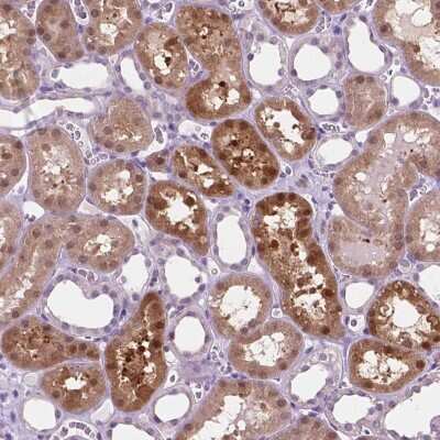 Immunohistochemistry: ACY3 Antibody [NBP2-48895] - Staining of human kidney shows moderate cytoplasmic and nuclear positivity in proximal renal tubules.