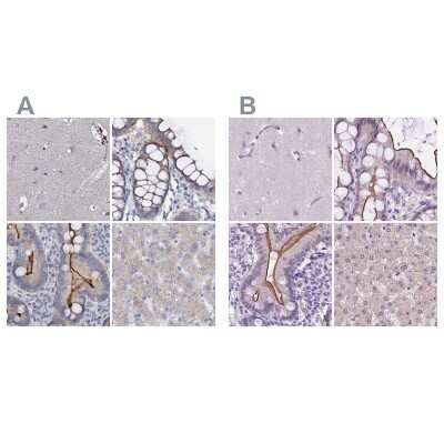 <b>Independent Antibodies Validation. </b>Immunohistochemistry-Paraffin: ACY3 Antibody [NBP1-89256] - Staining of human cerebral cortex, colon, duodenum and liver using Anti-ACY3 antibody NBP1-89256 (A) shows similar protein distribution across tissues to independent antibody NBP2-48895 (B).