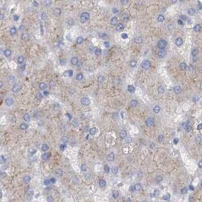 Immunohistochemistry-Paraffin: ACY3 Antibody [NBP1-89256] - Staining of human liver.