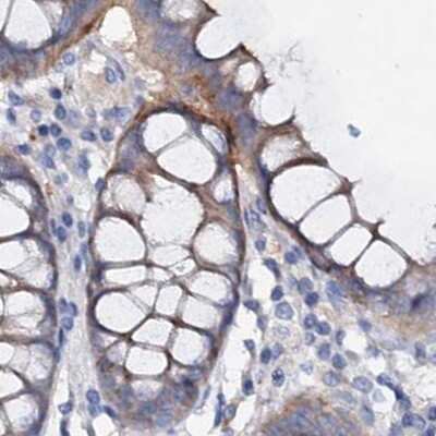Immunohistochemistry-Paraffin: ACY3 Antibody [NBP1-89256] - Staining of human colon.