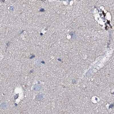 Immunohistochemistry-Paraffin: ACY3 Antibody [NBP1-89256] - Staining of human cerebral cortex.