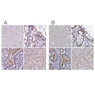 <b>Independent Antibodies Validation. </b>Immunohistochemistry-Paraffin: ACY3 Antibody [NBP2-48895] - Staining of human cerebral cortex, colon, duodenum and liver using Anti-ACY3 antibody NBP2-48895 (A) shows similar protein distribution across tissues to independent antibody NBP1-89256 (B).
