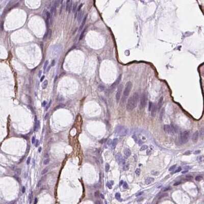 Immunohistochemistry-Paraffin: ACY3 Antibody [NBP2-48895] - Staining of human colon.