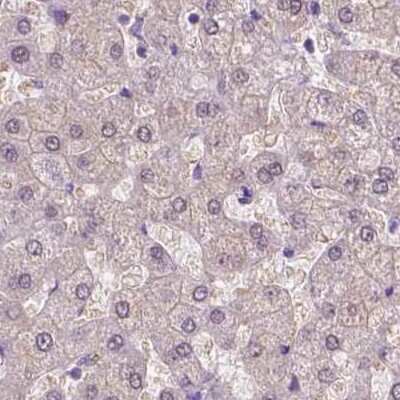 Immunohistochemistry-Paraffin: ACY3 Antibody [NBP2-48895] - Staining of human liver.